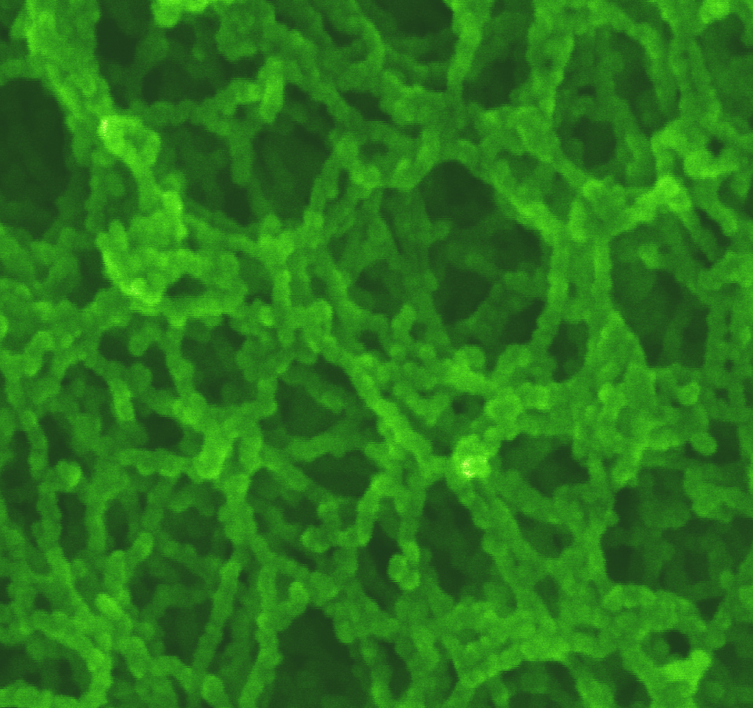 The structure of silica aerogels as seen through an scanning electron
microscope.